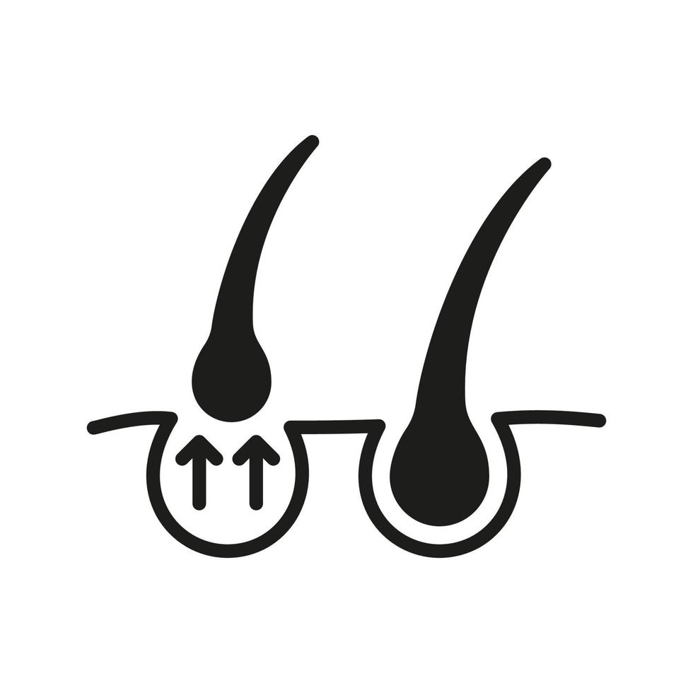Hair Loss